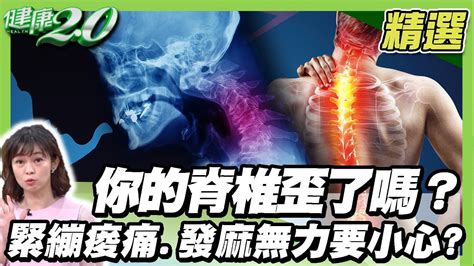 筋骨受傷|肌肉、筋骨、脊椎……痠痛問題要看哪一科？